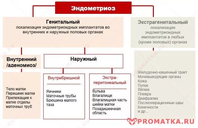 Норма эндометриоза. Классификация генитального эндометриоза. Классификация наружного генитального эндометриоза. Механизм развития эндометриоза. Наружный генитальный эндометриоз классификация.