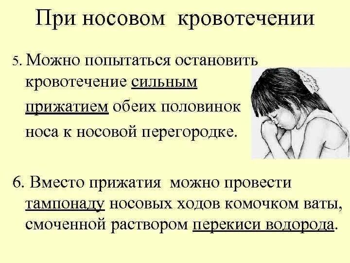 При носовом кровотечении. Носовое капиллярное кровотечение. Запрокидывание головы при носовом крово. Правильное положение головы при носовом кровотечении.