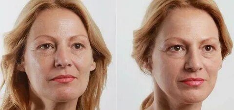 Лицо отзывы женщины
