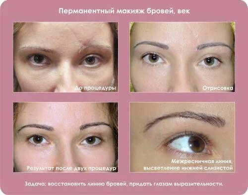 Можно делать перманент при месячных. Заживление перманентного макияжа бровей. перманент бровей заживление. заживление бровей после перманентного макияжа. перманентный макияж бровей сразу и после заживления.