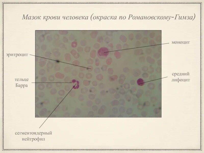 Мазок крови человека гистология препарат. Окраска мазка крови по Романовскому Гимза. Мазок крови человека окраска по Романовскому Гимза. Мазок крови человека гистология препарат по Романовскому Гимзе. Тельце гейнца