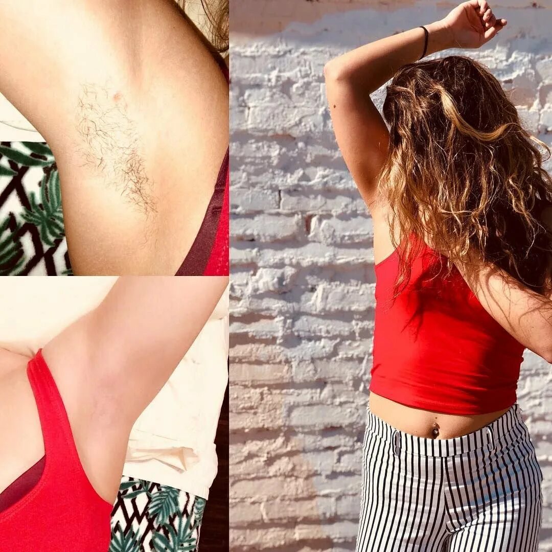 Со скольки лет волосы на подмышках. Длинные волосы под мышками. Со скольки лет волосы на подмышках. Лазерная эпиляция до и после. После лазерной эпиляции.