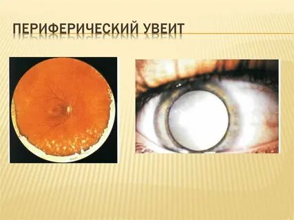 Уевит