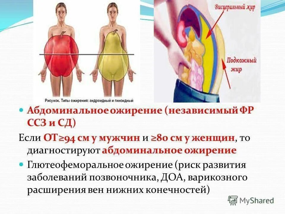 Откуда жир. Висцеральный и абдоминальный тип ожирения. ожирение 1 степени абдоминальный тип. висцеральное ожирение 1 степени. висцеральный тип ожирения.