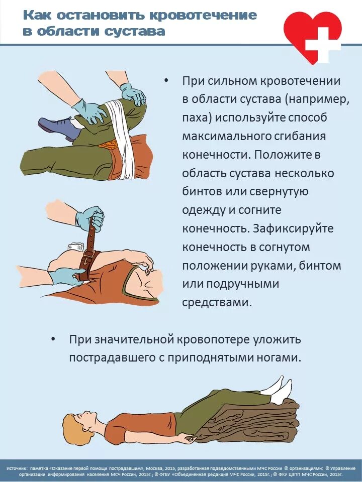 Как Остановить кровотечение. Как основать кровотечение. Как остановитьткровотечение. КСК Остановить кровотечение. Останавливать кровотечение путем