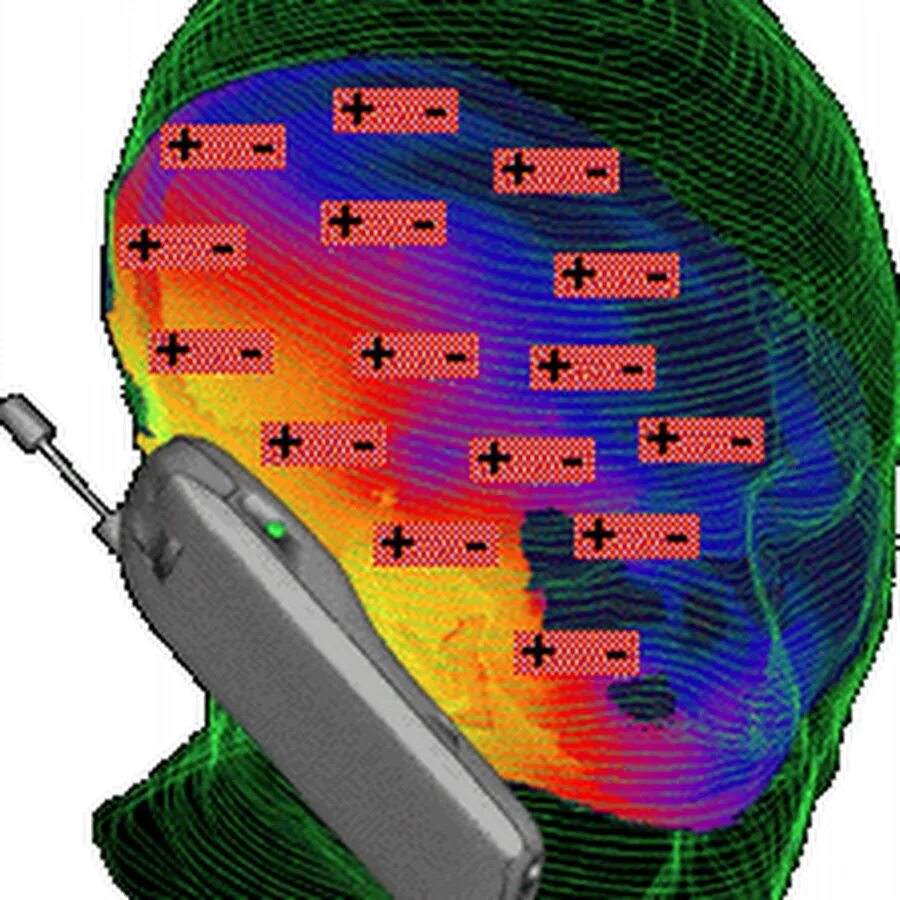 Мозг магнитное поле. Электромагнитное излучение сотовых телефонов. Электромагнитное излучение от телефона. Влияние электромагнитного излучения на мозг. Мозг человека электромагнитное излучение.