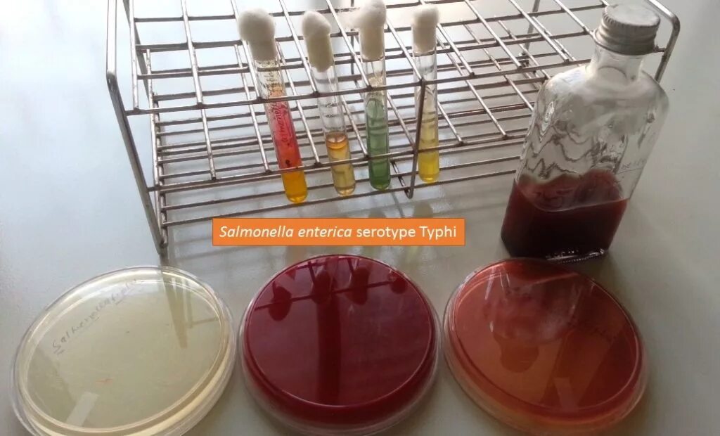 Salmonella typhi микробиология. Сальмонелла Тифи микробиология. Сальмонелла энтерика Тифи. Посев на сальмонеллез