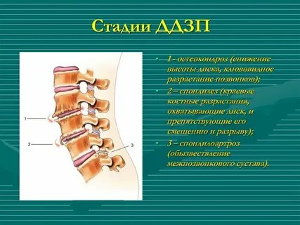 Шоп 2 степени