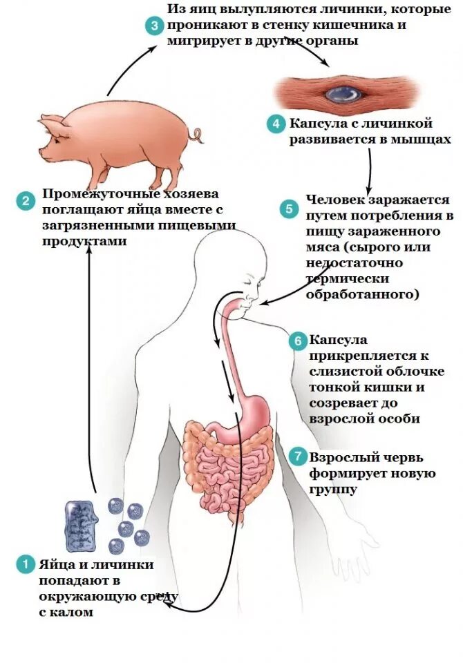 Источник инвазии больной человек. Жизненный цикл балантидия схема. Жизненный цикл балантидия кишечного схема. Пути заражения человека балантидия кишечного. Balantidium coli цикл развития.