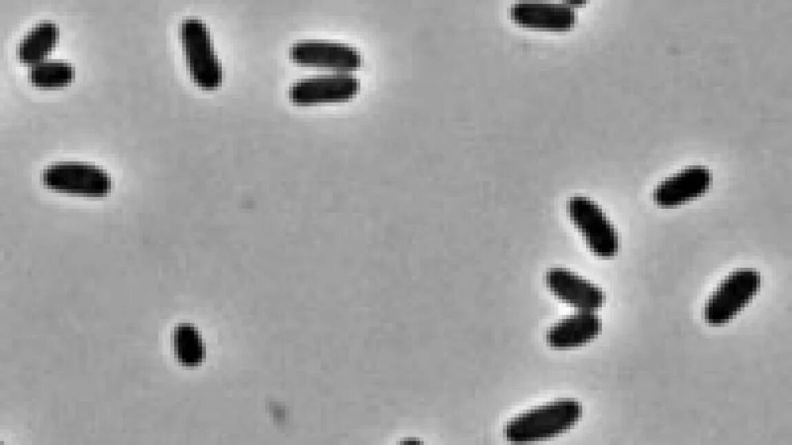 Corynebacterium spp в мазке у мужчин. Corynebacterium diphtheriae под микроскопом. corynebacterium glutamicum. corynebacterium glutamicum таксономия. corynebacterium ammoniagenes.