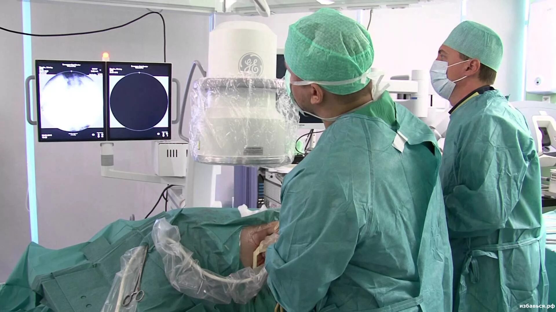 нефролитотрипсия перкутанная лазерная. камни в почках операцию делают. оперировать камень почки. хирургическое вмешательство при мочекаменной болезни. камни в почках операцию делают.