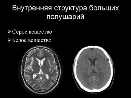 Отделы серого вещества мозга