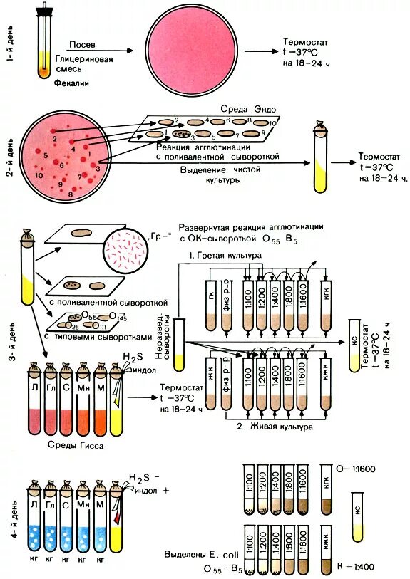 Схема выделения и идентификации энтеропатогенных кишечных палочек. Бактериологическое исследование схемой микробиология. Диагностика кишечной палочки микробиология. Схема микробиологического исследования ботулизма. 2 этап бактериологического метода