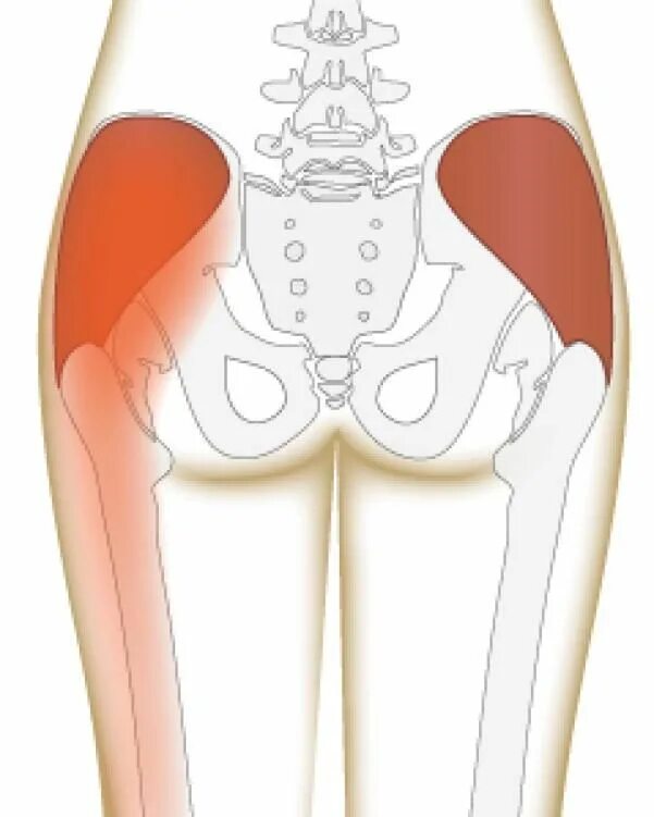Боль в бедре спереди