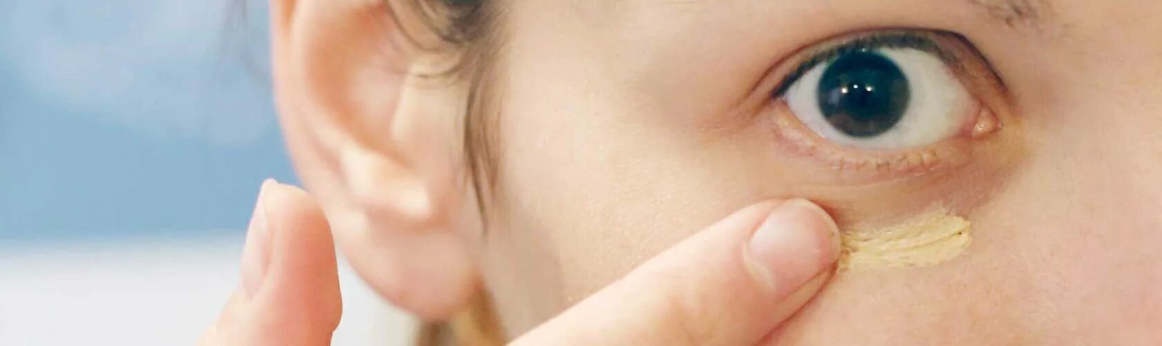 чернота вокруг глаз. желтая кожа вокруг глаз. желтая кожа вокруг глаз. серо желтые глаза. гиперпигментация кожи век.