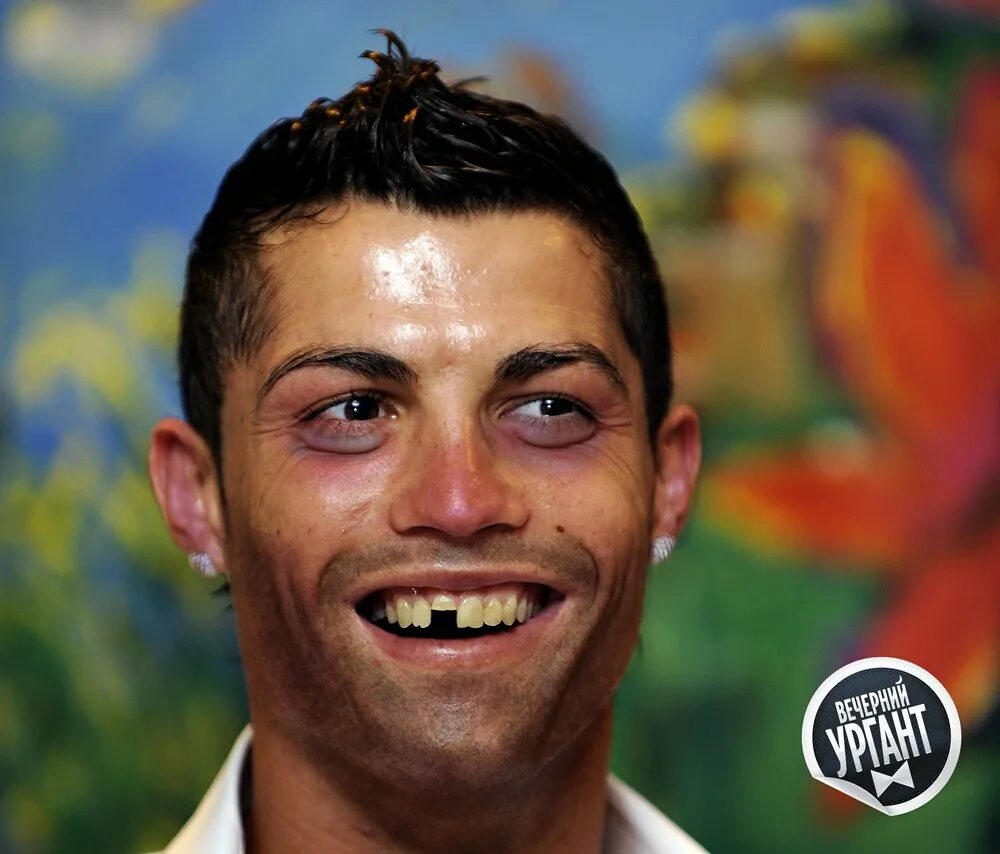 Роналду виниры. Роналдо зубы. Криштиану роналду брекеты. Криштиану роналду брекеты. Роналдо зубы.