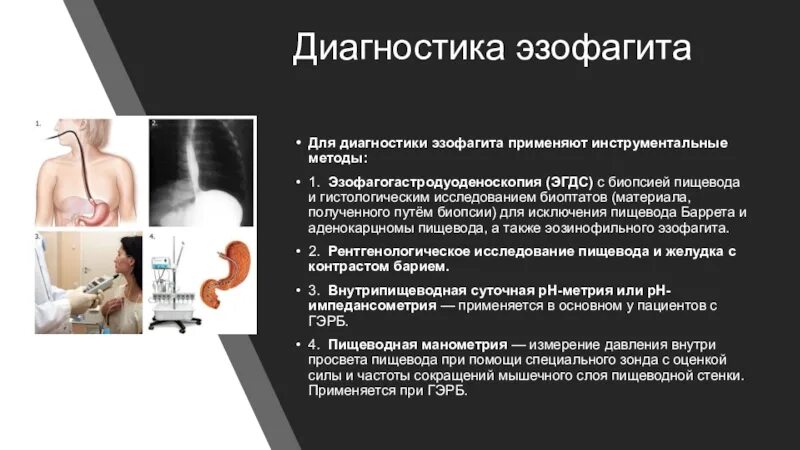 Рефлюкс-эзофагите биопсия. Эзофагит лечение отзывы