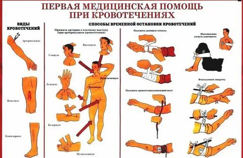 Способам остановки кровотечения при ранении лица
