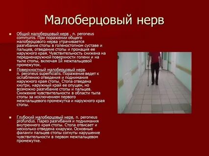 Нейропатия малоберцового нерва