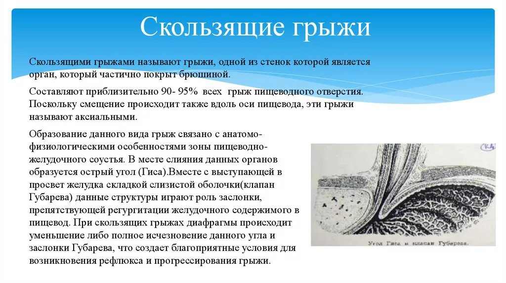 Грыжи студфайл. Скользящие шиыжи. особенности скользящей грыжи.