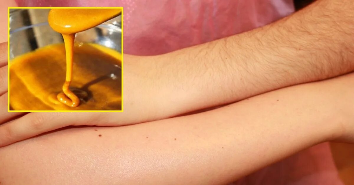 Можно во время месячных делать депиляцию