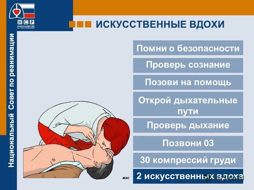 Приемы искусственного дыхания. Слр 30 компрессий 2 вдоха. Порядок выполнения искусственного дыхания. Алгоритм оказания искусственного дыхания. Техники выполнения искусственного дыхания.