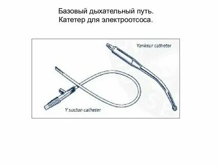 Катетер во время родов