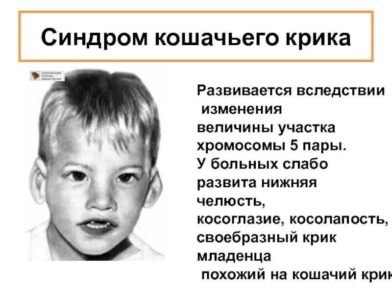 Кошачья болезнь у детей