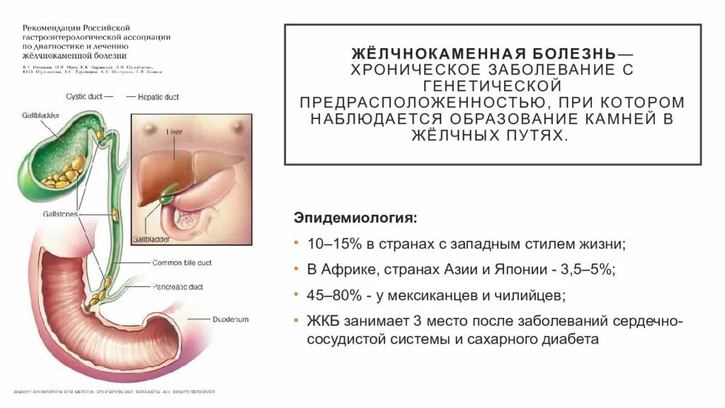 Кал при желчном пузыре. Холедохолитиаз презентация. Холедохолитиаз симптомы. Холедохолитиаз осложнения.