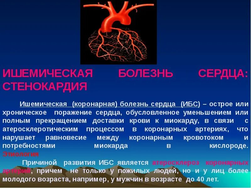 Ишемическая болезнь сердца. Ишемическая болезнь сердца (ИБС). Ишемическая болезнь сердца доклад.