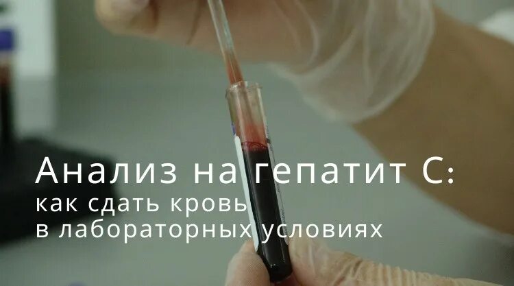 Перед сдачей анализа на гепатит. Взятие крови из вены на гепатиты. Сдать кровь на гепатит. Забор крови вирусных гепатитов.