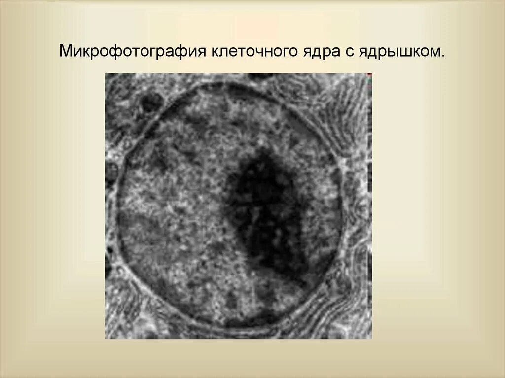 Ядро клетки микрофотография. Ядро клетки в электронный микроскоп. Электронная микрофотография клетки. Ядрышко электронограмма. Ядро растительной клетки микрофотография.