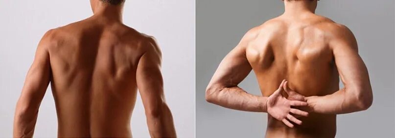 Нормальная поясница. Ровная мужская спина. Здоровая ровная спина мужская. Спина человека вид сбоку. Ровная осанка у мужчины.