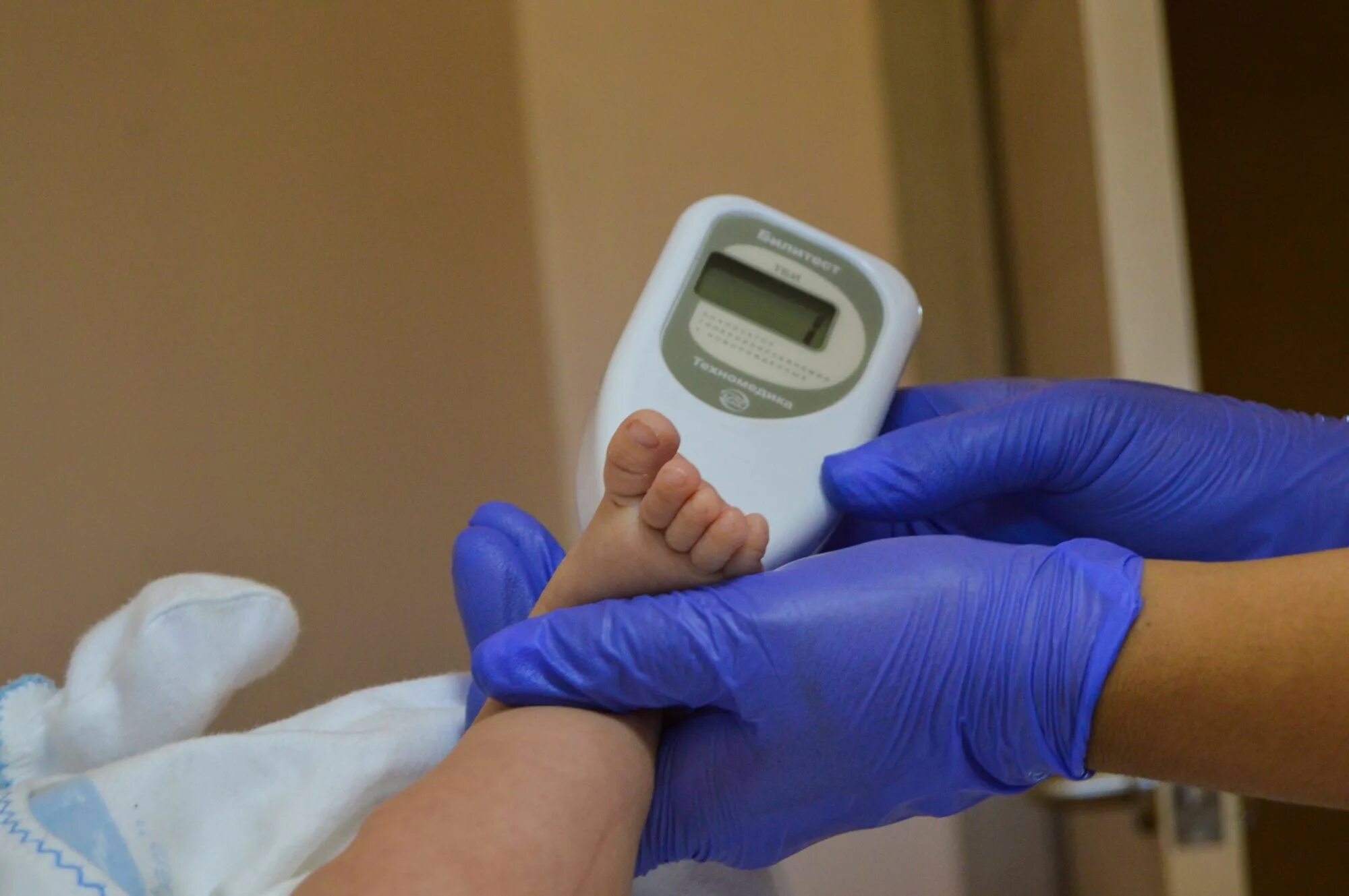 Транскутанный билирубинометр билитест 2000. Анализатор фотометрический "билитест". Транскутанный билитест. Гемоглобинометр фотометрический портативный агф-03/540 "минигем". Анализатор "билитест 2000.