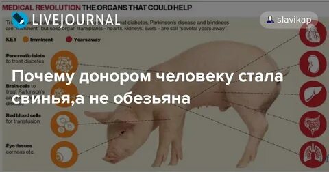 Органы свиньи подходит человеку