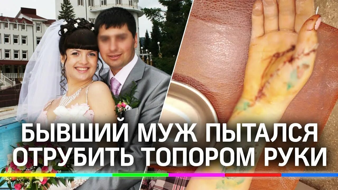 Мужчине отрубили руки. Мужчина отрезал руки из за ревности.