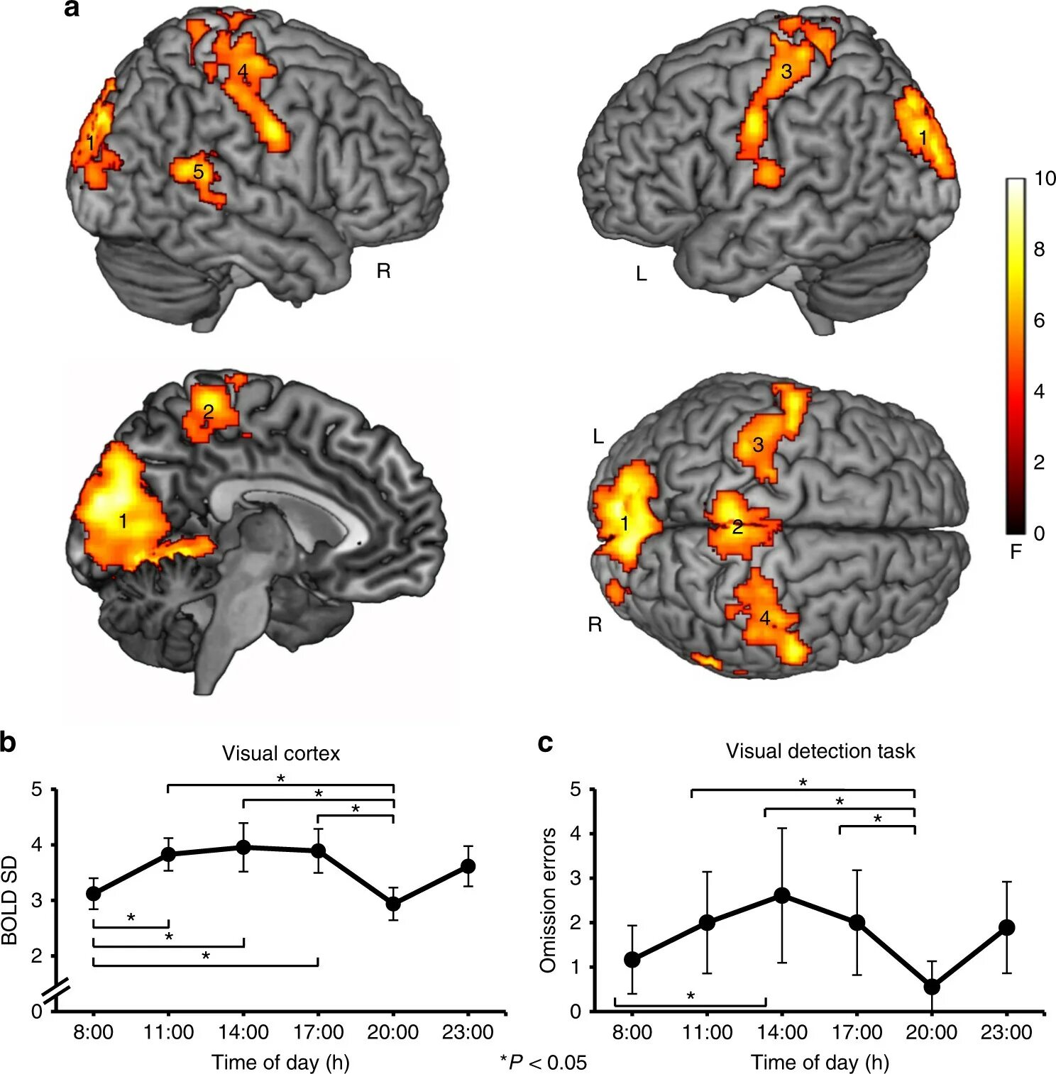 Visual Cortex. Visual Cortex Training. The Dynamic Brain. Hyperoriension column in Visual Cortex Color. 372 brain