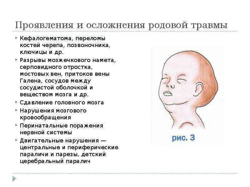 Перелом позвоночника у ребенка последствия. Осложнения при родовой травме. Родовая травма шейного отдела позвоночника. Родовая травма осложнения.