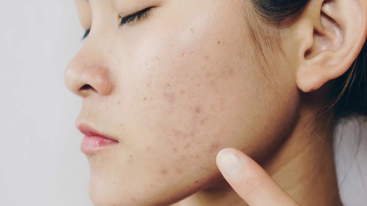 Problem skin. Problem skin