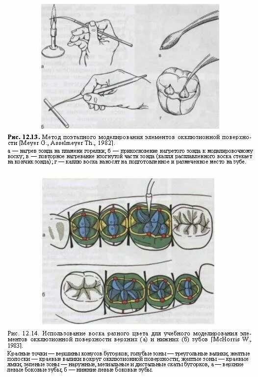 Техника наложения окклюзионной. Гнатологические основы моделирования окклюзионной поверхности. Окклюзионный компас в стоматологии схема. Моделирование по окклюзионному компасу.