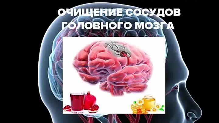 Сосуды головного мозга отзывы. Очищение сосудов головного. очистка сосудов головного мозга. очистки от сосудов головного мозга.