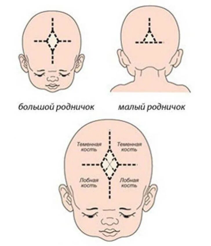 Большой Родничок и малый Родничок у новорожденного. Череп новорожденного большой и малый Родничок. Родничок у новорожденных норма по месяцам. Большой и малый Родничок у новорожденного зарастает.