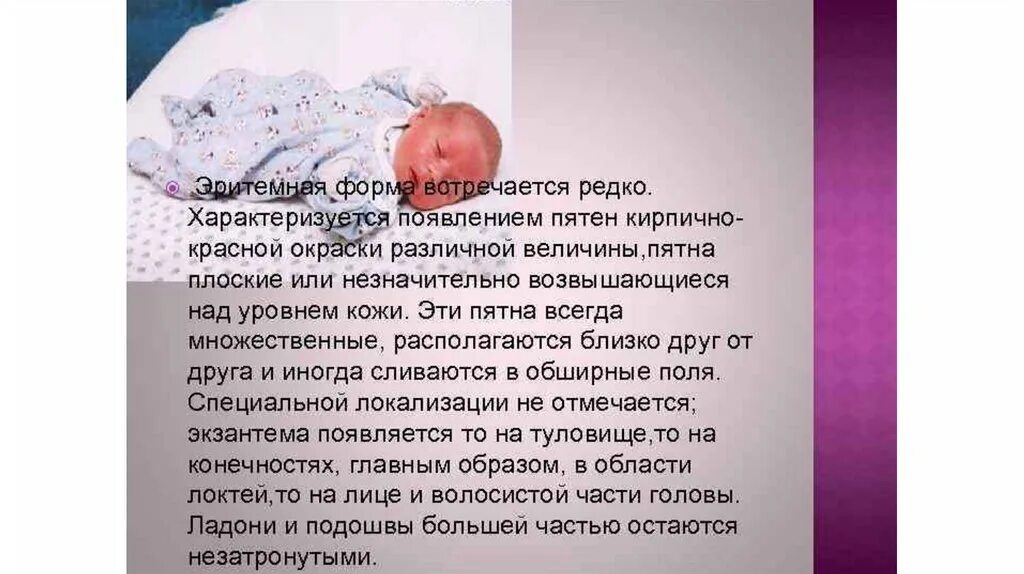 Неонатальная токсическая эритема. Тронзиторные изменения кожных покров. Новорожденный токсический. Новорожденный токсический. Токсическая эритема новорожденных.