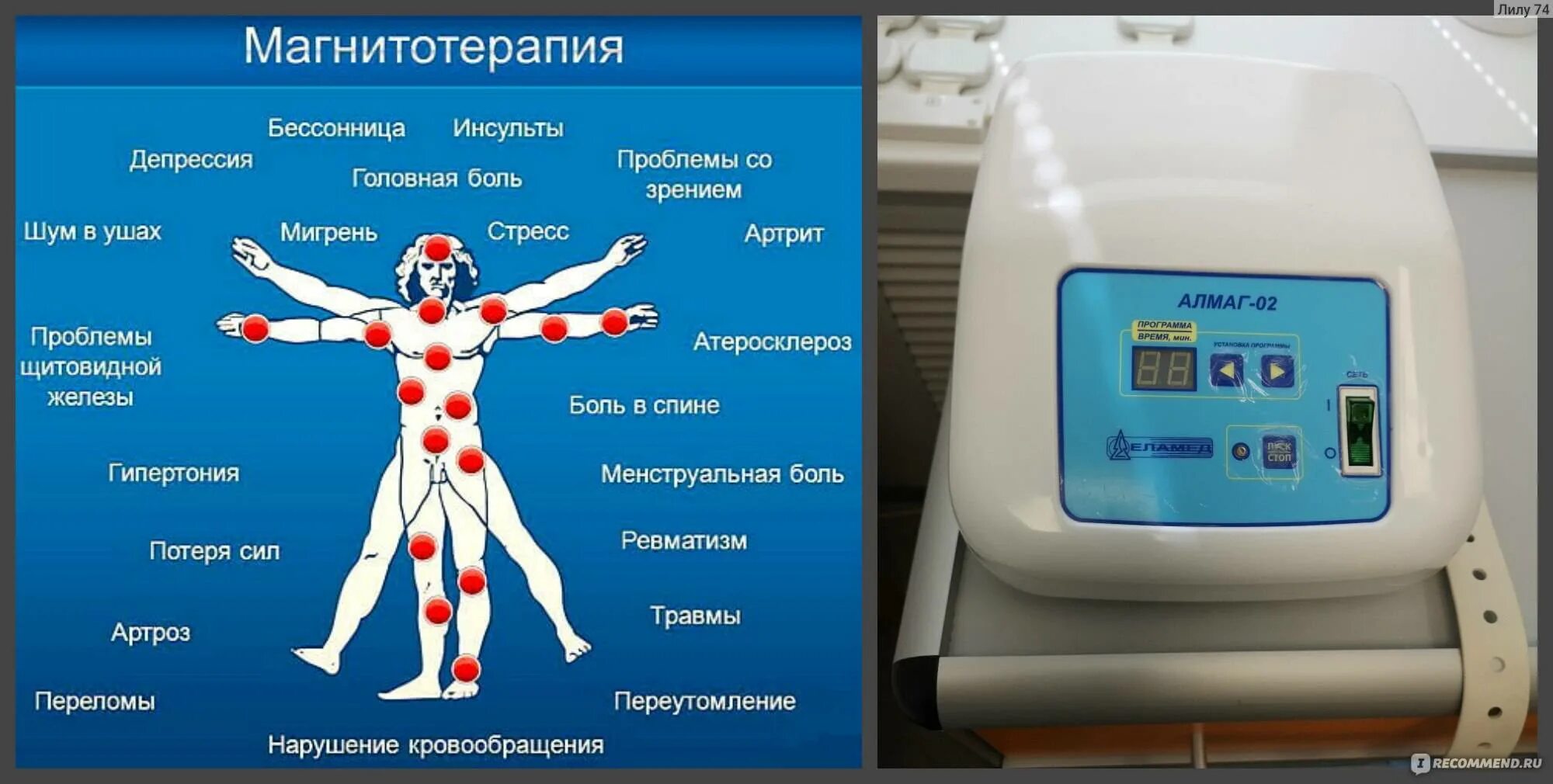 Магнитотерапия алгоритм. Магнитотерапия. физиотерапия магнитотерапия. низкочастотная магнитотерапия. магнитотерапия противопоказания.