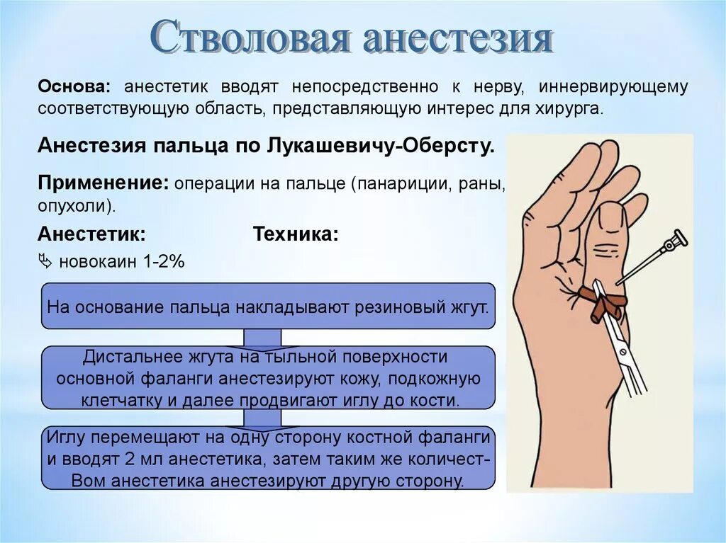 Новокаином можно обезболить. Анестезия пальца по Лукашевичу. Проводниковая анестезия пальца. Местная анестезия по Оберсту-Лукашевичу.