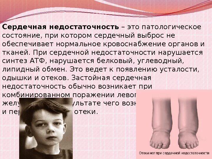 Состояние при сердечной недостаточности. Цвет кожи при сердечной недостаточности. Сердечная недостаточность это патологическое состояние. Цвет кожи ног при сердечной недостаточности. Точки при сердечной недостаточности.