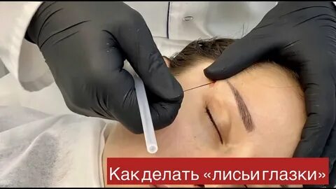 Операция лисьи глазки