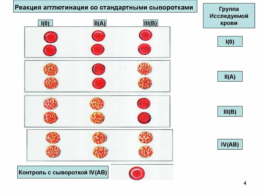 3 группа крови голубая. Реакция агглютинации группы крови. Сыворотка агглютинации 1 и 3 группы крови. 1 Группа крови агглютинация. Реакция агглютинации при определении группы крови.