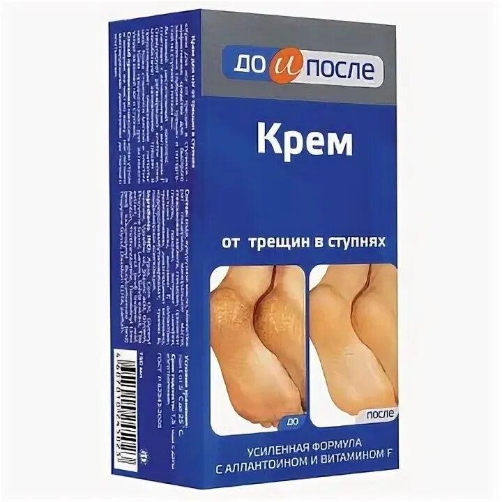 Помощь от трещин на пятках. Крем для ног от трещин в ступнях, &quot;до и после&quot;, 150 мл. до и после крем от трещин в ступнях 150мл. крем для ног от трещин на пятках. до и после крем для ног от трещин в ступнях.