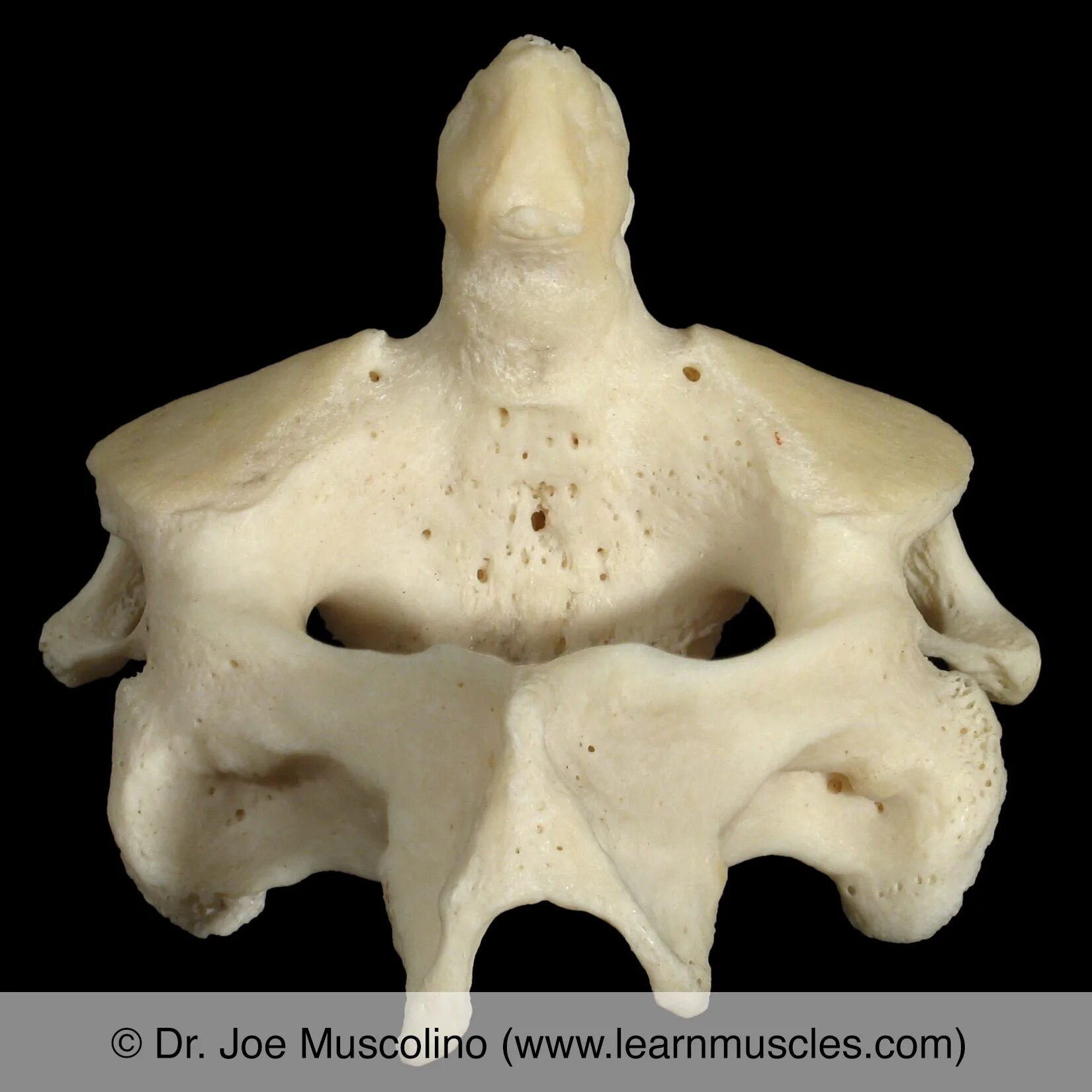 Axis c. Axis c2 vertebrae. эпистрофей мамонта. аксис титан. аксис звёздные.